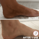 Esfresh - Luva Esfoliante - Shop Da Fábrica