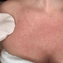 Esfresh - Luva Esfoliante - Shop Da Fábrica